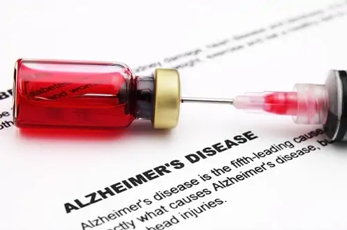 More-Evidence-For-The-Strange-Link-Between-Sugar-And-Alzheimer's