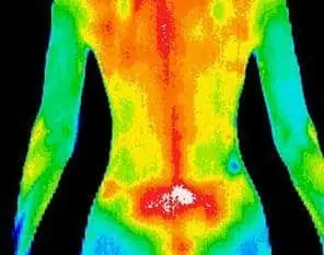 Thermography Body Scan