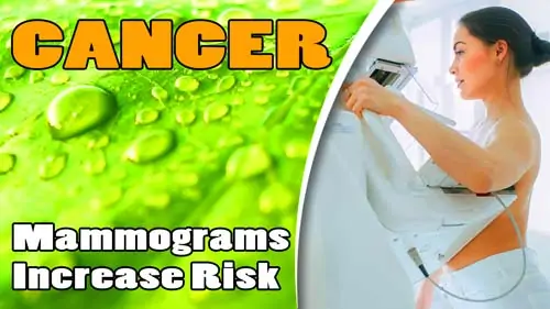 Mammograms-Increase-Risk-of-Cancer